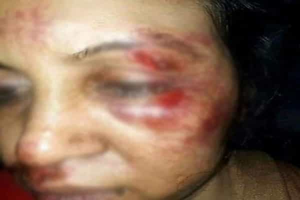அரசின் தவறுகளை கேள்வி கேட்டதால் பத்திரிகையாளர் தாக்கப்பட்டாரா ?
