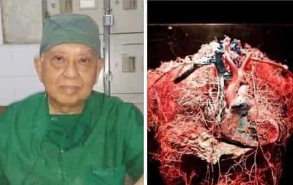 சர்க்கரை எடுத்துக் கொள்வதை நிறுத்தினால் புற்றுநோய் செல்கள் இறக்குமா ?