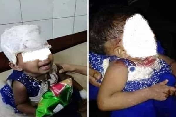 மேற்கு வங்கம் முஸ்லீம்களால் தாக்கப்பட்ட குழந்தையா ?| உண்மை அறிக.