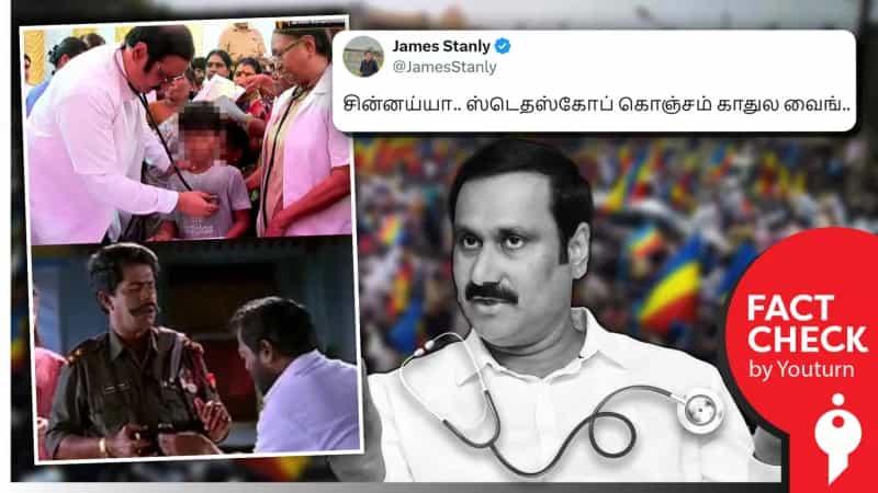 ஸ்டெதஸ்கோப்பை காதில் மாட்டாமல் பரிசோதனை செய்தாரா அன்புமணி? உண்மை என்ன?