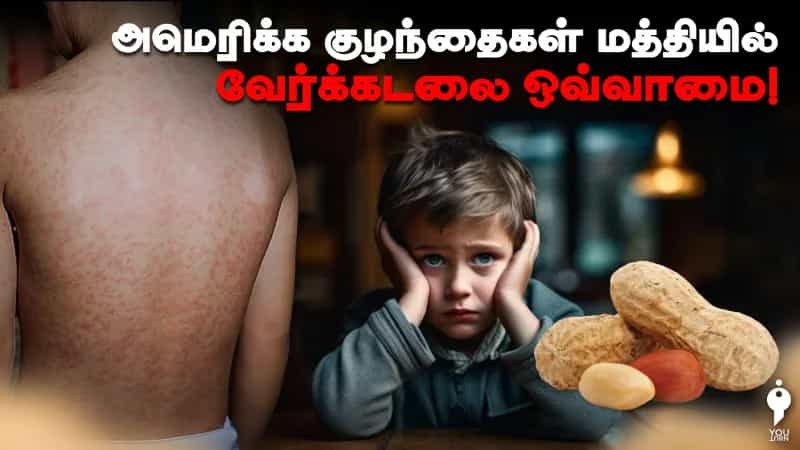 அமெரிக்க குழந்தைகள் மத்தியில் வேர்க்கடலை ஒவ்வாமை!