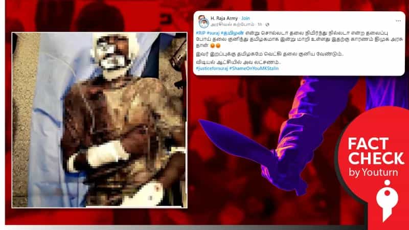 அரிவாளால் வெட்டப்பட்ட வடமாநில இளைஞர் உயிரிழந்துவிட்டதாகப் பரவும் செய்தி! உண்மை என்ன? 