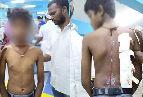 என்றைக்கு ஒழியும் சாதிக் கொடுமை.. சக மாணவனை பிளேடால் கிழித்த சம்பவம் !