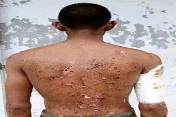 சீன வீரர்களால் தாக்கப்பட்ட இந்திய ராணுவ வீரரின் புகைப்படமா ?